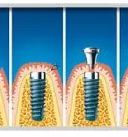 Ugoden zobni rentgen ljubljana