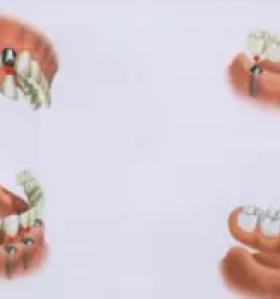 Ugoden zobni rentgen ljubljana