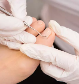 Ugodno urejanje stopal maribor