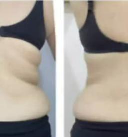 Ugodna kavitacija domzale