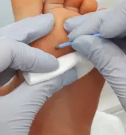 Ugodna medicinska pedikura savinjska