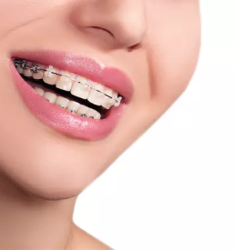 Ugodne zobozdravstvene storitve 