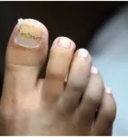 Vrascen noht slovenija