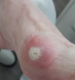 Vrascen noht slovenija