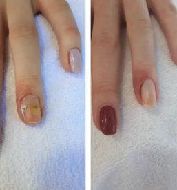 Vrascen noht slovenija