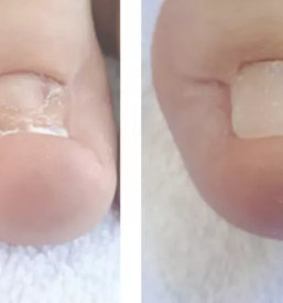 Vrascen noht slovenija