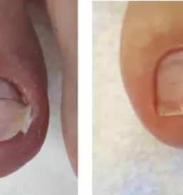 Vrascen noht slovenija