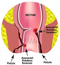 Zasebna ambulatna za proktologijo in abdominalno kirurgijo zahodna slovenija