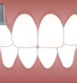 Zasebna zobna ordinacija zasavje