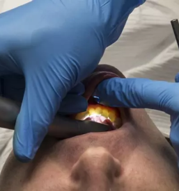 Zobozdravstvo odraslih