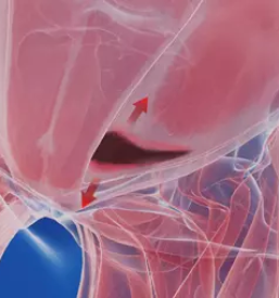 Zasebni kirurg za sportnikovo kilo zahodna slovenija