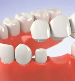 Zdravljenje zobnih bolezni obala