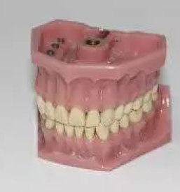 Zobna protetika postojna
