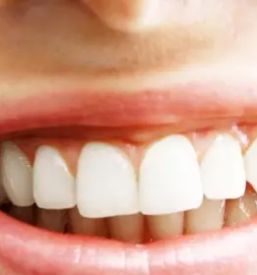 Zobne luske ljubljana