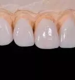 Zobni laboratorij v ljubljani