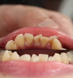 Zobozdravnik na koncesijo crnomelj
