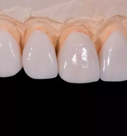 Zobozdravstvene storitve jvp dental maribor