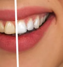 Zobozdravstvene storitve jvp dental maribor