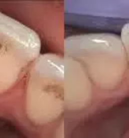 Zobozdravstvo dr borec ljubljana