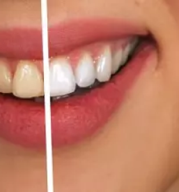 Zobozdravstvo in oralna kirurgija posavje