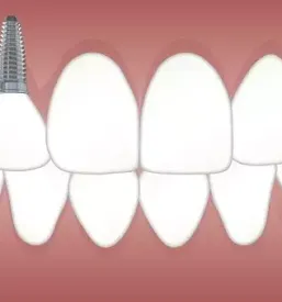 Dentalna protetika Postojna, Primorska