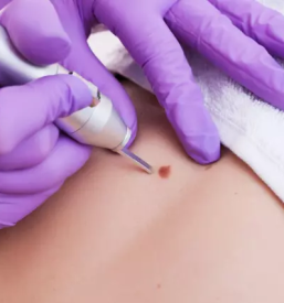 Dermatolog prekmurje