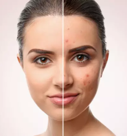 Dermatolog prekmurje