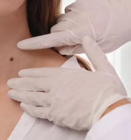 Dermatolog prekmurje