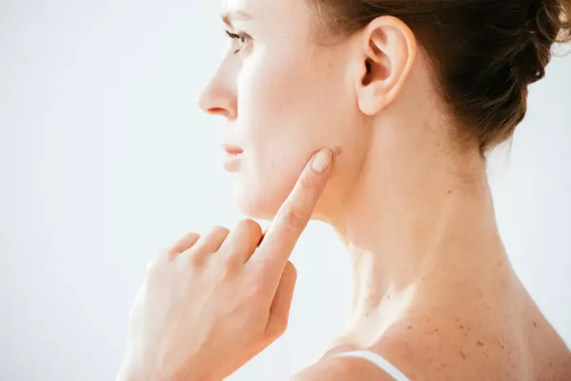 Smo eden najboljših dermatologov v Prekmurju, ki vam nudi kakovostno in celovito obravnavo