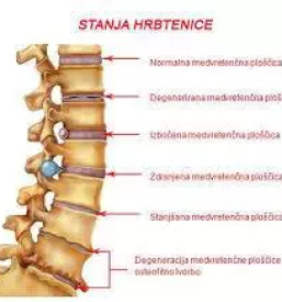 Dober fizioterapevt dolenjska