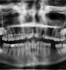 Kvalitetna zobna protetika Štajerska