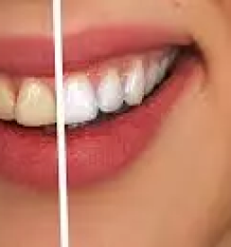 Estetsko zobozdravstvo celje