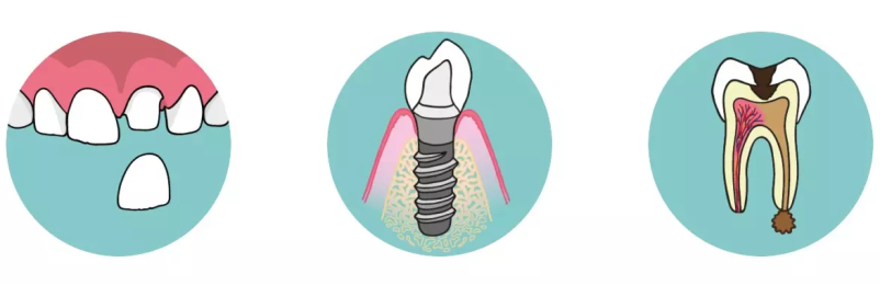 Dobra implantologija Kranj