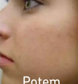 Kozmeticni salon radovljica