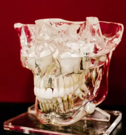 Kvalitetna implantologija celje