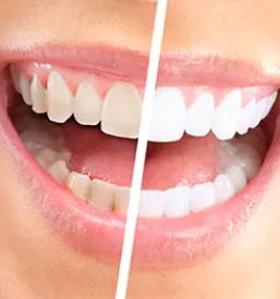 Kvalitetna izdelava implantatov maribor