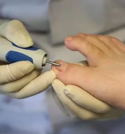 Kvalitetna medicinska pedikura vrhnika in okolica