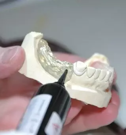 Kvalitetna zobna protetika stajerska