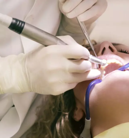 Kvalitetni implantati celje