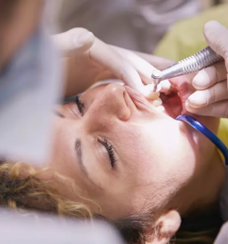 Kvalitetni implantati celje