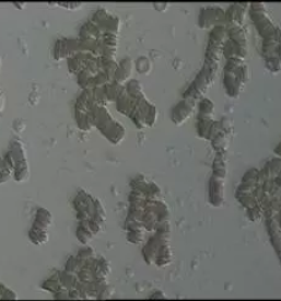 Kvalitetno ugotavljanje alergij za otroke in odrasle ljubljana