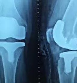 Ortopedska ambulanta ljubljana