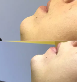 Pomlajevanje obraza Slovenija