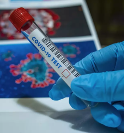 Samoplacniski pcr testi goriska