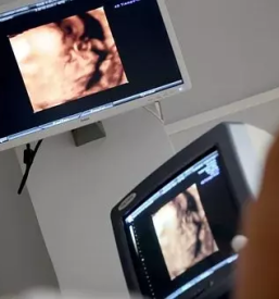 Samoplacniski ultrazvok dojk ljubljana