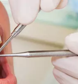 Samoplacniski zobozdravnik crnomelj