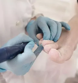 Sanacija vrascenih nohtov domzale