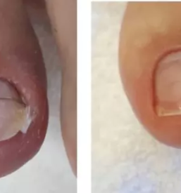 Sodoben center medicinske pedikure slovenija