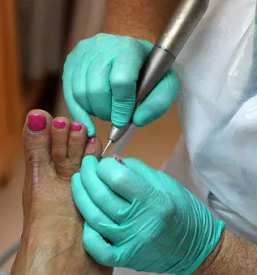 Ugodna pedikura maribor