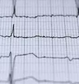 Ultrazvočni pregledi srca zreče